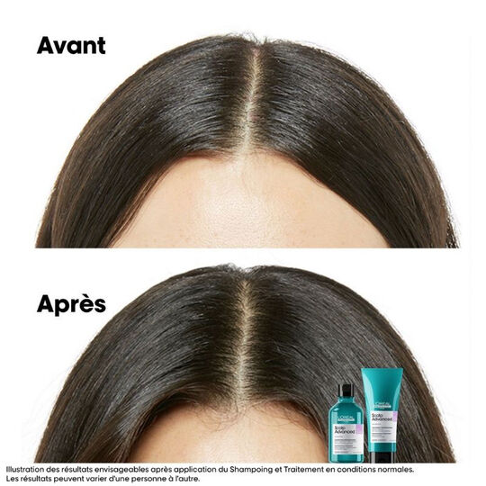 Duo recharge Scalp Advanced + shampooing 300ml