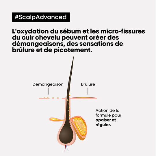 Shampooing dermo-régulateur anti-inconfort Scalp Advanced 500ml